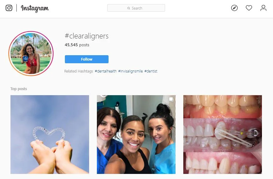 Perfil da Dra. Carla no Instagram com publicações sobre alinhadores.